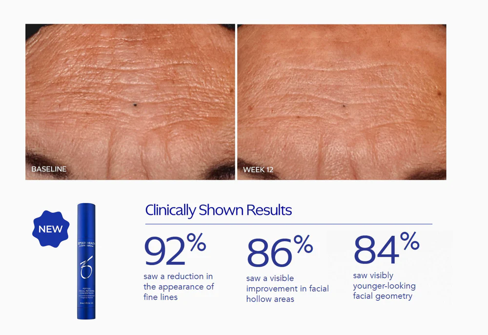 ZO SKIN HEALTH - Peptide Facial Refining Concentrate - Image 3